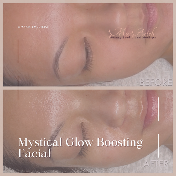 Before and after facial results from Mystical Glow Boosting Facial in Edmonton